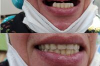 لابراتور دندانسازی موسوی در اصفهان