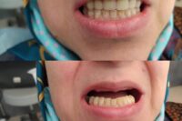 لابراتور دندانسازی موسوی در اصفهان