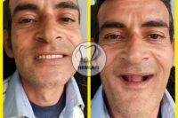 بهترین دندانسازی در اصفهان | کلینیک دندانسازی نمونه