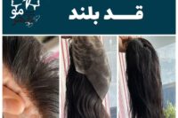 پروتز مو اصفهان | دکتر پروتز مدرس و متخصص حمید ولی خانی