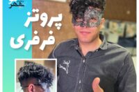 پروتز مو اصفهان | دکتر پروتز مدرس و متخصص حمید ولی خانی