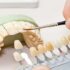 بهترین دندانسازی در کاشان | کلینیک دندانسازی نمونه