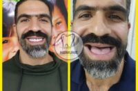 بهترین دندانسازی در نجف آباد | کلینیک دندانسازی نمونه