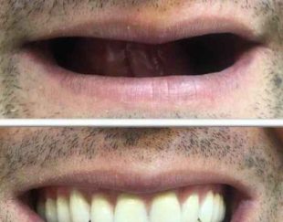 بهترین دندانسازی در همدان | دندانسازی سلامت – دکتر مــهدوی | قسطی و چکی