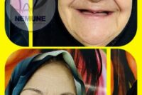 بهترین دندانسازی شمال تهران | کلینیک دندانسازی نمونه