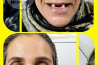 بهترین دندانسازی در یوسف آباد | کلینیک دندانسازی نمونه