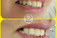 بهترین دندانسازی غرب تهران | کلینیک دندانسازی نمونه