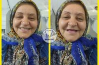 بهترین دندانسازی شمال تهران | کلینیک دندانسازی نمونه