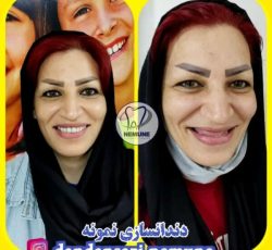 بهترین دندانسازی در جنوب تهران | کلینیک دندانسازی نمونه