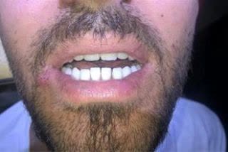 دندانسازی در همدان