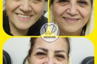 بهترین دندانسازی در تهران ویلا | دندانسازی نمونه + آدرس