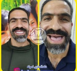 بهترین دندانسازی در بهارستان تهران | دندانسازی نمونه + شماره تماس و آدرس