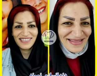 بهترین دندانسازی در تهران ویلا | دندانسازی نمونه + آدرس