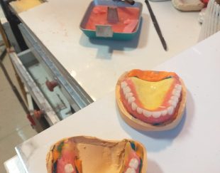 لابراتوار دندانسازی ساخت و تعمیر دندان مصنوعی بیلیچینگ نایت گارد