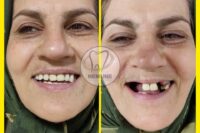 بهترین دندانسازی در پیروزی | کلینیک دندانسازی نمونه
