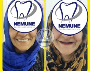 بهترین دندانسازی در تهرانپارس | کلینیک دندانسازی نمونه