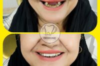 بهترین دندانسازی در فاطمی | کلینیک دندانسازی نمونه