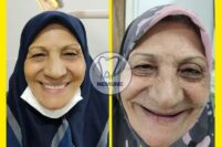 بهترین دندانسازی در تهرانپارس | کلینیک دندانسازی نمونه