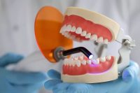 بهترین دندانسازی در تجریش